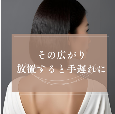 湿気に負けない艶髪へ｜乾かすだけで決まる最新ケア